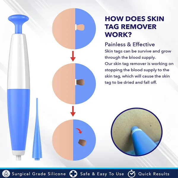 Auto Skin Tag Removal Kit - Easy At-Home Skin Tag Remover