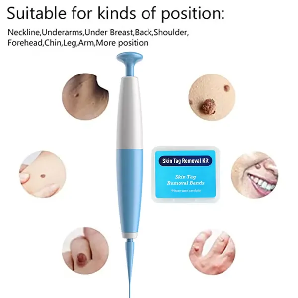Auto Skin Tag Removal Kit - Easy At-Home Skin Tag Remover