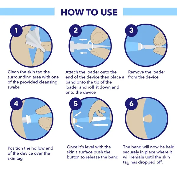 Auto Skin Tag Removal Kit - Easy At-Home Skin Tag Remover